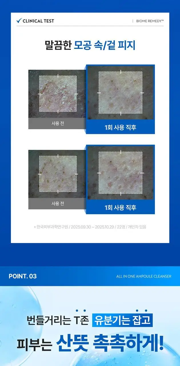 [스킨케어링 80% 클렌저]유이크 바이옴 레미디 올인원 앰플 클렌저 200ml 상세페이지 21